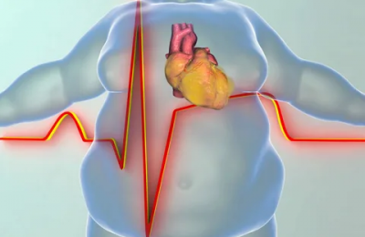 Как лишние килограммы влияют на сердце и сосуды
