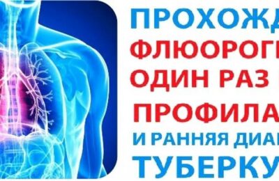 В Сузунском муниципальном округе продолжает работу передвижная флюорографическая установка (ПМК-ФЛГ).